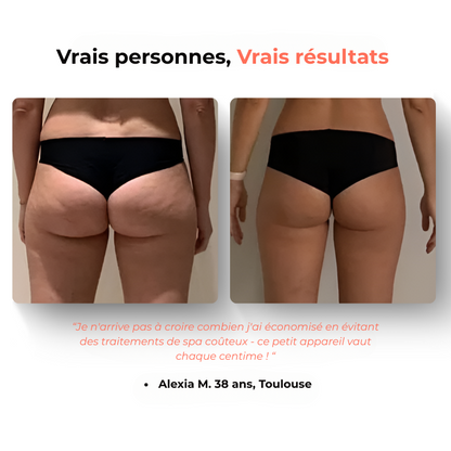 GlowFit 2.0 Masseur Anti- Cellulite