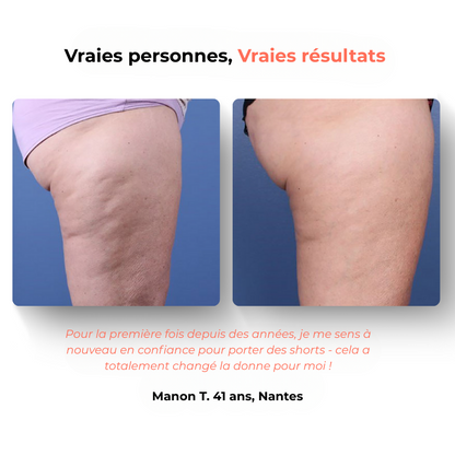 GlowFit 2.0 Masseur Anti- Cellulite