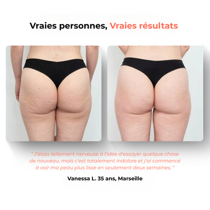 GlowFit 2.0 Masseur Anti- Cellulite